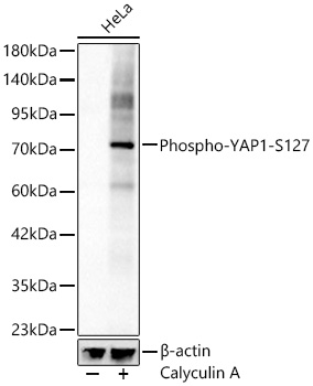 Phospho-YAP1-S127 Rabbit mAb