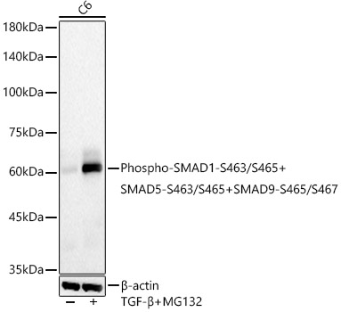 Phospho-SMAD1-S463/S465+SMAD5-S463/S465+SMAD9-S465/S467 Rabbit mAb