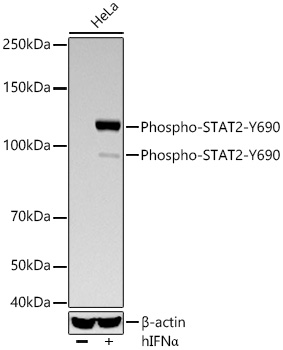 Phospho-STAT2-Y690 Rabbit mAb