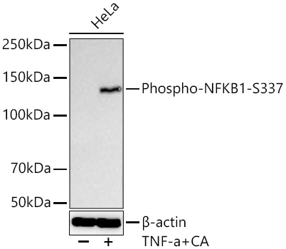 Phospho-NFKB1-S337 Rabbit mAb