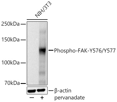 Phospho-FAK-Y576/Y577 Rabbit mAb