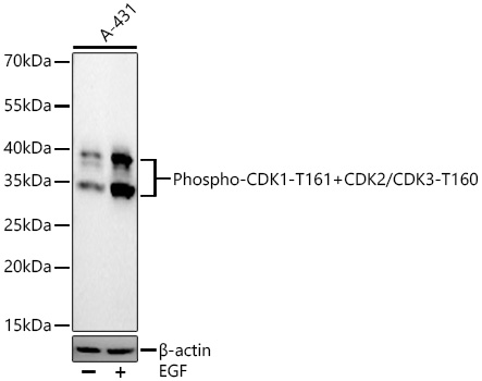 Phospho-CDK1-T161+CDK2/CDK3-T160 Rabbit mAb