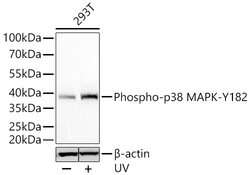 Phospho-p38 MAPK-Y182 Rabbit mAb