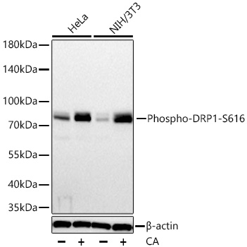 Phospho-DRP1-S616 Rabbit mAb