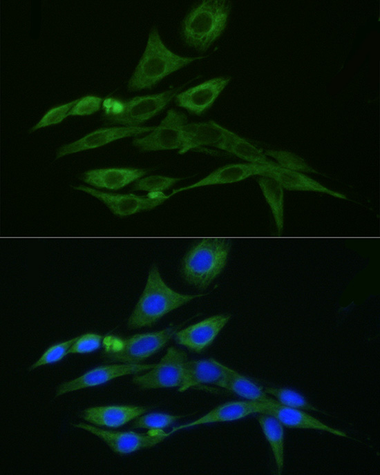 FITC-conjugated Donkey anti-Rabbit IgG (H+L)