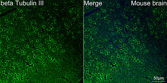 FITC-conjugated F(ab')₂ Fragment Goat anti-Rabbit IgG, Fc fragment specific