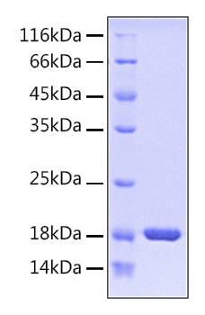 Recombinant Human PIN1 Protein