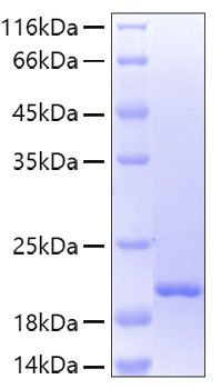 Recombinant Human Lipocalin-2/NGAL/LCN2 Protein