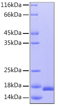 Recombinant Human IL-36Ra/IL-1F5 Protein