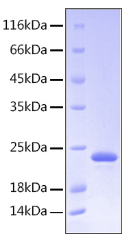 Recombinant Human Somatotropin/GH-N/GH1 Protein