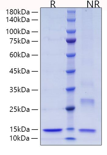 Recombinant Human Thioredoxin/SASP/TXN Protein