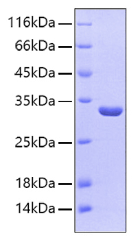 Recombinant Human Sulfotransferase 1A1/SULT1A1 Protein