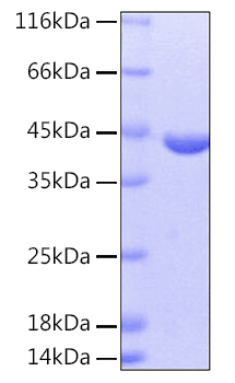 Recombinant Human cAspAT/AATC/GOT1 Protein