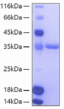 Recombinant Human TIE2/TEK/CD202b Protein