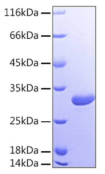 Recombinant Human Galectin-3/LGALS3 Protein