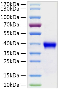 Recombinant Human R-spondin-1/RSPO1 Protein