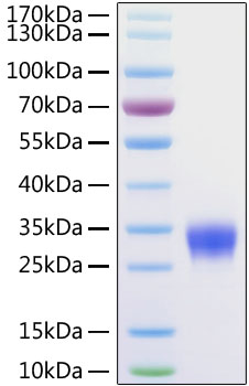 Recombinant Human Fc gamma RIIB/FCGR2B/CD32b Protein