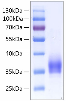 Recombinant Human IL-2RA/CD25 Protein