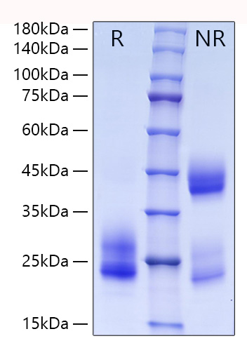 Recombinant Human CD69 Protein