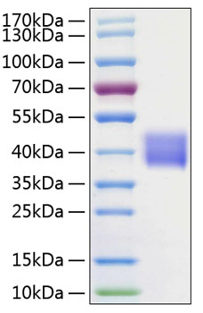 Recombinant Human Kallikrein-1/KLK1 Protein