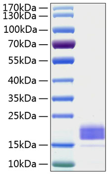 Recombinant Human TIGIT Protein