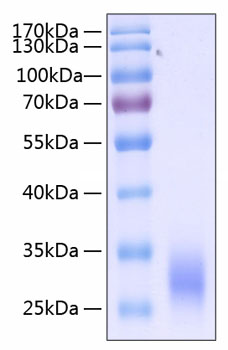 Recombinant Human Fc gamma RIIA/FCGR2A/CD32a (H167R) Protein