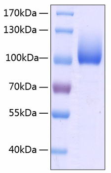 Recombinant Human LIMP II/SCARB2/CD36L2 Protein