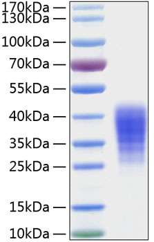 Recombinant Human Leukemia inhibitory factor/LIF Protein