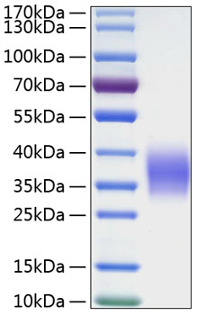 Recombinant Human Ephrin-B2/EFNB2 Protein