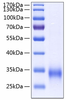 Recombinant Human MBP-C/MBL-2 Protein