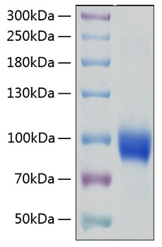 Recombinant Human IL-18R1/CD218a Protein