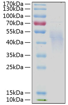 Recombinant Human IL-4R alpha/CD124 Protein