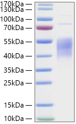 Recombinant Human IL-4R alpha/CD124 Protein