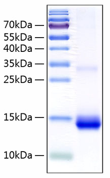 Recombinant Human Cystatin-SN/CST1 Protein