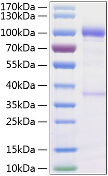 Recombinant Human GDNFR-alpha-1/GFRA1 Protein