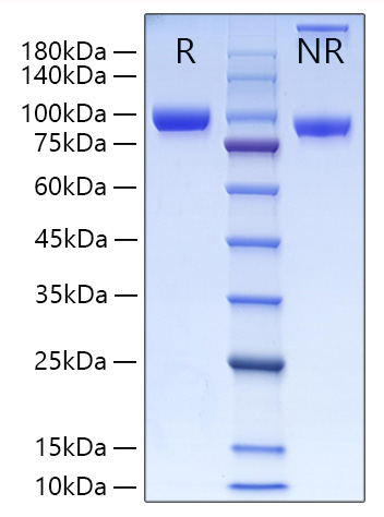 Recombinant Human MMP-9 Protein