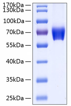 Recombinant Human Basigin/EMMPRIN/CD147 Protein