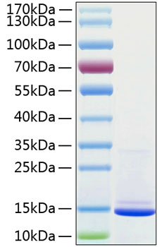 Recombinant Human Beta-2-microglobulin/B2M Protein