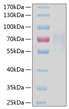 Recombinant Human TNFRSF8/CD30 Protein