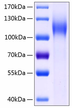 Recombinant Human CDH17/LI-cadherin Protein