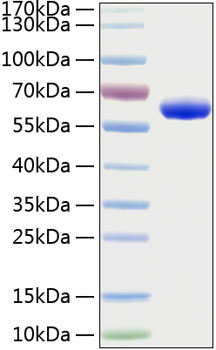 Recombinant Human Erythropoietin R/EPO-R Protein