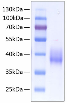 Recombinant Human Coagulation factor III/Tissue factor/CD142 Protein