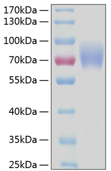 Recombinant Human FCAR/CD89 Protein