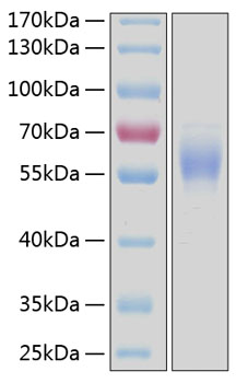 Recombinant Human DDR2/CD167b Protein