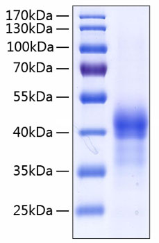 Recombinant Human Lung surfactant protein D/SFTPD(E22G) Protein