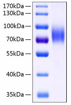 Recombinant Human MIC-B Protein