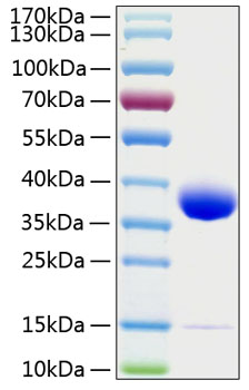 Recombinant Human Prolactin receptor/PRL-R Protein