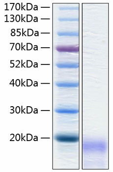 Recombinant Human CEACAM3/CD66d Protein