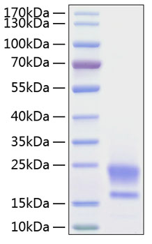 Recombinant Human WAP5/WFDC2/HE4 Protein