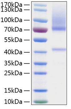 Recombinant Human Glypican-3/GPC3 Protein